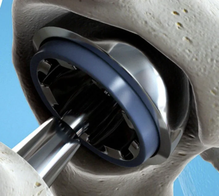 400T Orthopaedic Fittings Press finished product 5